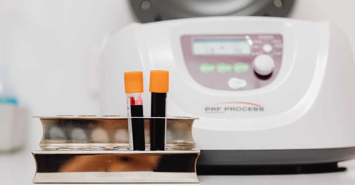 Échantillons de sang dans un support avec centrifugeuse dans un environnement de laboratoire.